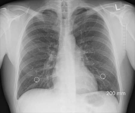 xray-radiographie