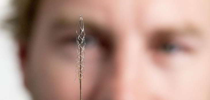 implant cérébral