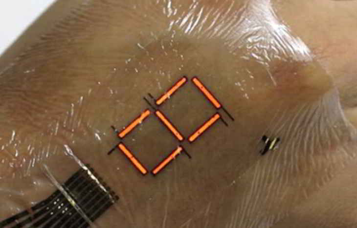 patch-peau-elec