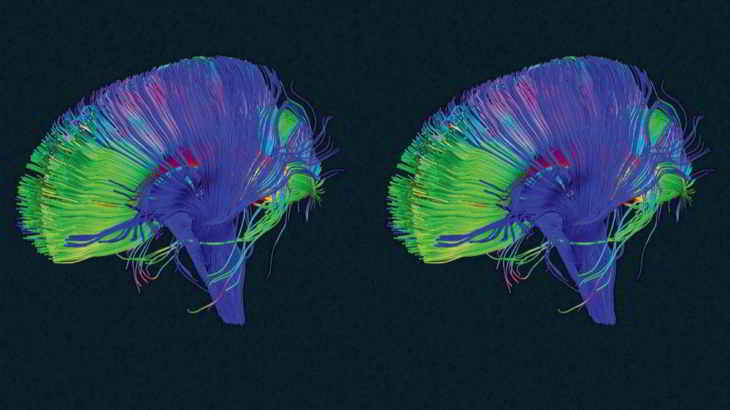 cerveau-bouton-supprimer