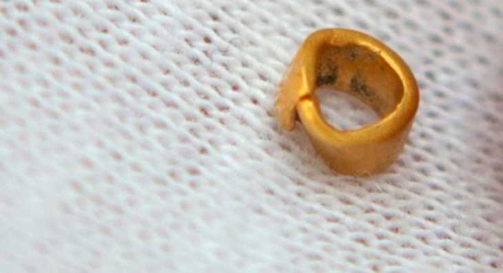 artefact-or