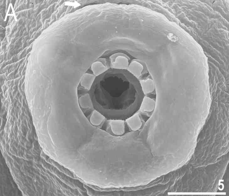 Tardigrade