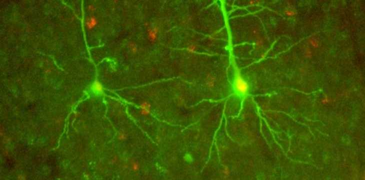 communication neuronale