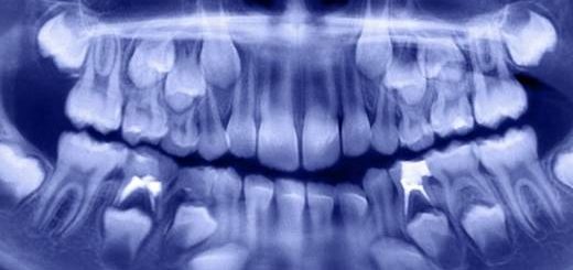 500-dents-enfant