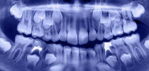 500-dents-enfant