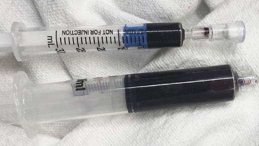sang-bleu-médicaments